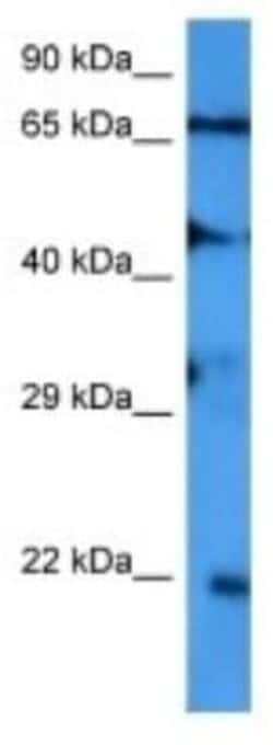 SAR1B Rabbit anti-Human, Polyclonal, Novus Biologicals 100 &mu;g; Unconjugated:Antibodies,
